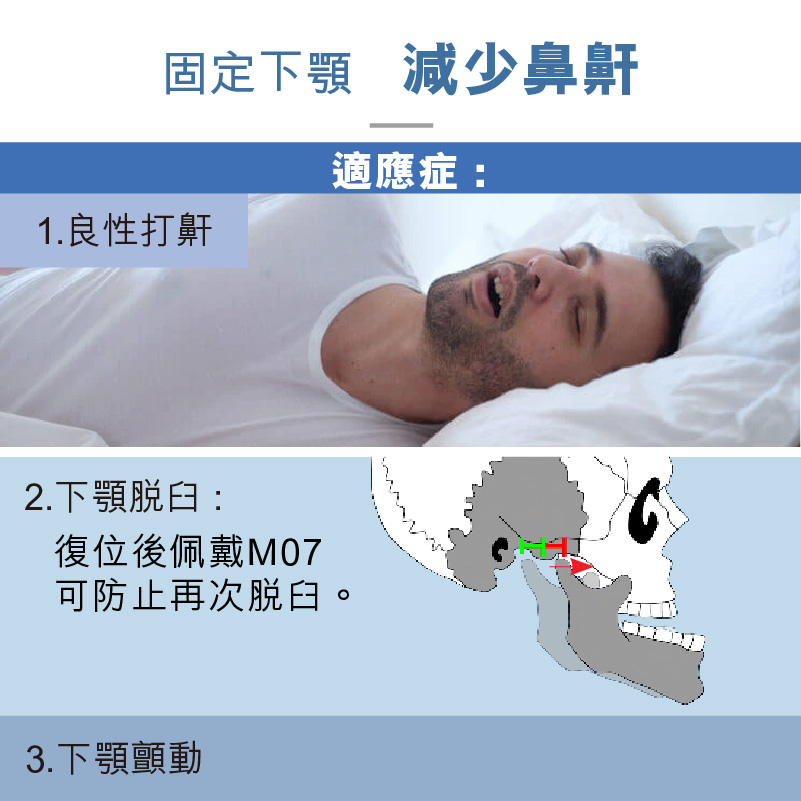 M07